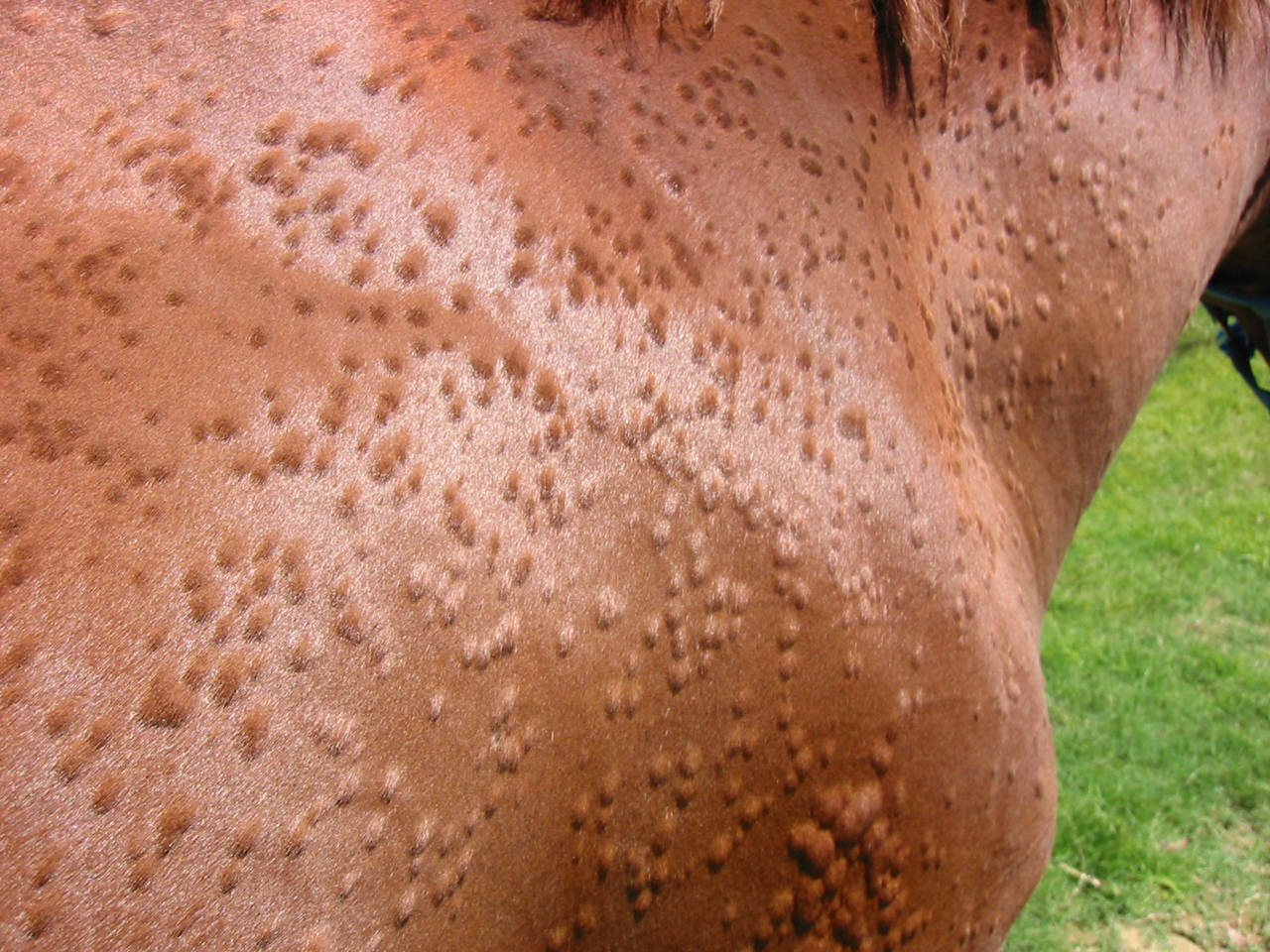 Hives (urticaria)
